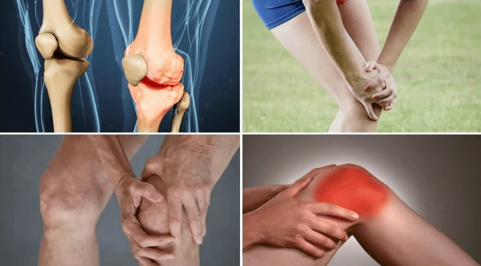 Symptômes d'arthrose
